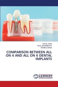 bokomslag Comparison Between All on 4 and All on 6 Dental Implants