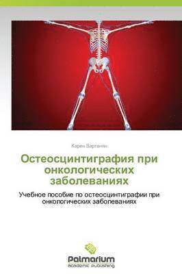 Osteostsintigrafiya Pri Onkologicheskikh Zabolevaniyakh 1