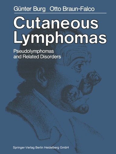 G. Burg, O. Braun-Falco - Cutaneous Lymphomas, Pseudolymphomas, and Related Disorders, Häftad