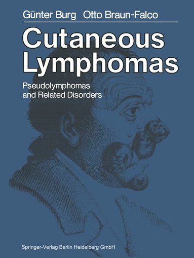 bokomslag Cutaneous Lymphomas, Pseudolymphomas, and Related Disorders