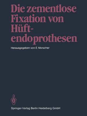 Die zementlose Fixation von Hftendoprothesen 1