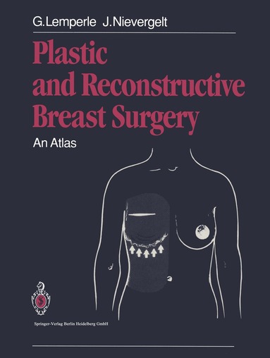 Gottfried Lemperle, Jürg Nievergelt - Plastic and Reconstructive Breast Surgery, Häftad