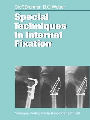 bokomslag Special Techniques in Internal Fixation