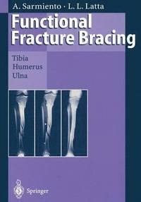 bokomslag Functional Fracture Bracing