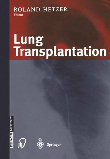 R. Hetzer - Lung Transplantation, Häftad