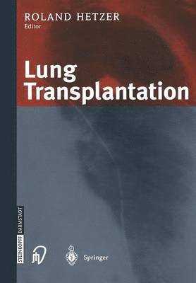 bokomslag Lung Transplantation