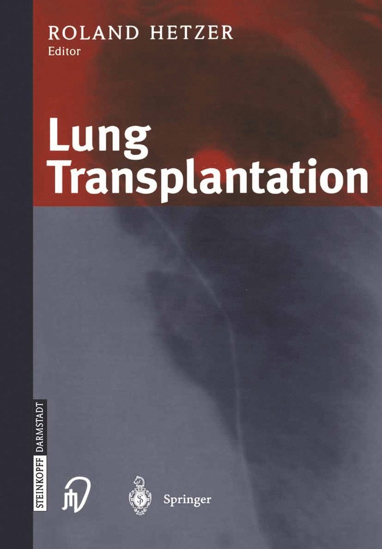 R. Hetzer - Lung Transplantation, Häftad