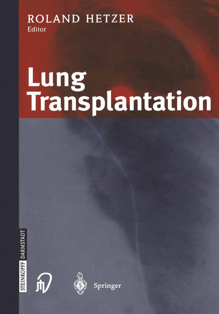 Lung Transplantation 1