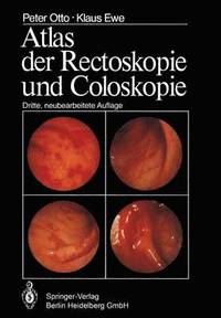 bokomslag Atlas der Rectoskopie und Coloskopie