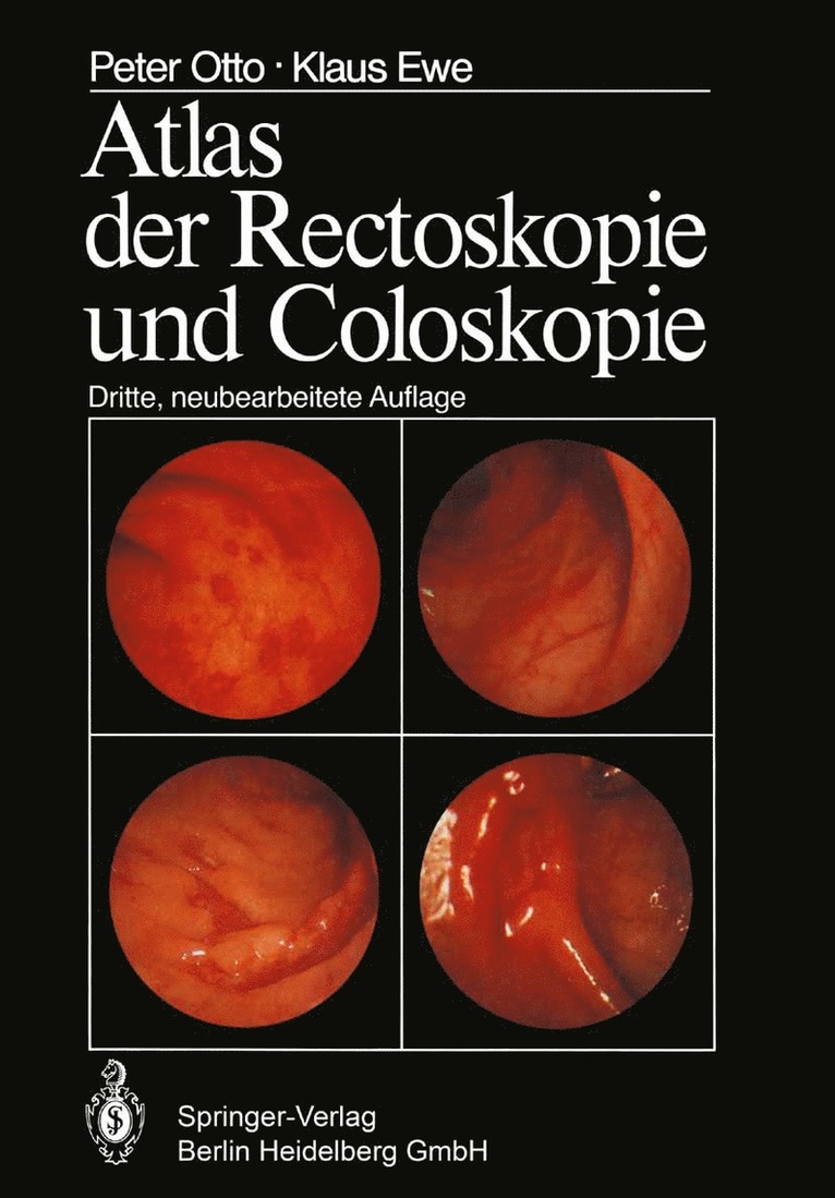 P. Otto, K. Ewe - Atlas der Rectoskopie und Coloskopie, Häftad