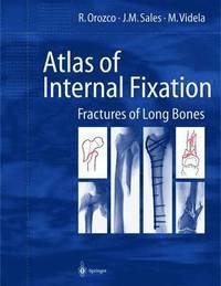 bokomslag Atlas of Internal Fixation