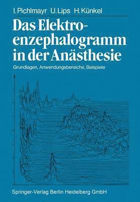 bokomslag Das Elektroenzephalogramm in der Ansthesie