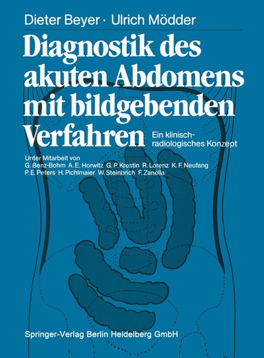 Dieter Beyer, Ulrich Mödder, Dieter Beyer - Diagnostik des akuten Abdomens mit bildgebenden Verfahren, Häftad