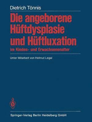 bokomslag Die angeborene Hftdysplasie und Hftluxation im Kindes- und Erwachsenenalter