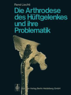 Die Arthrodese des Hftgelenkes und ihre Problematik 1