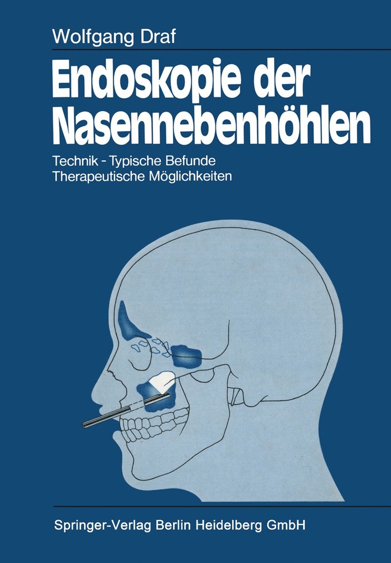 Wolfgang Draf - Endoskopie der Nasennebenhöhlen, Häftad