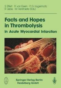 bokomslag Facts and Hopes in Thrombolysis in Acute Myocardial Infarction