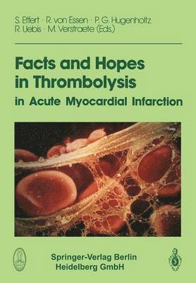 Facts and Hopes in Thrombolysis in Acute Myocardial Infarction 1