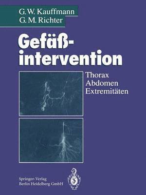 Gefintervention 1