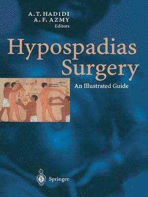 bokomslag Hypospadias Surgery