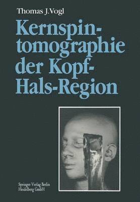 bokomslag Kernspintomographie der Kopf-Hals-Region