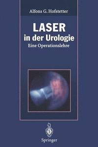 bokomslag Laser in der Urologie
