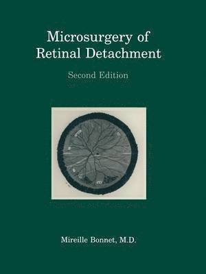 Microsurgery of Retinal Detachment 1