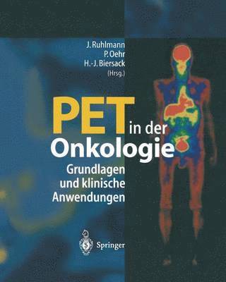 bokomslag PET in der Onkologie