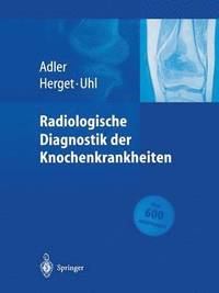 bokomslag Radiologische Diagnostik der Knochenkrankheiten