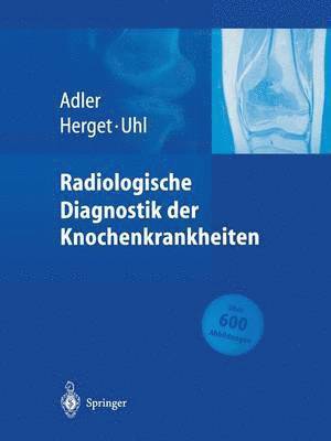 Radiologische Diagnostik der Knochenkrankheiten 1