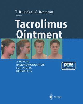 Tacrolimus Ointment 1