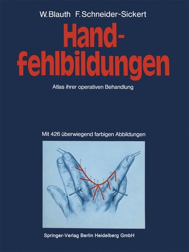 bokomslag Handfehlbildungen