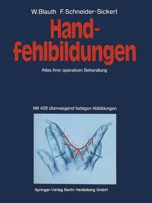 Handfehlbildungen 1