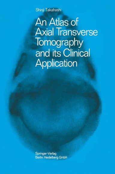 bokomslag Atlas of Axial Transverse Tomography and its Clinical Application