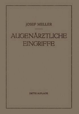 Augenrztliche Eingriffe 1