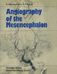 bokomslag Angiography of the Mesencephalon