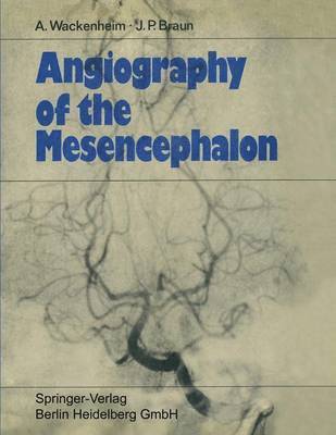 Angiography of the Mesencephalon 1