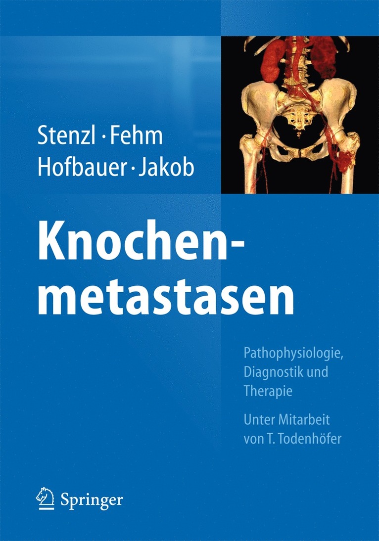 Knochenmetastasen