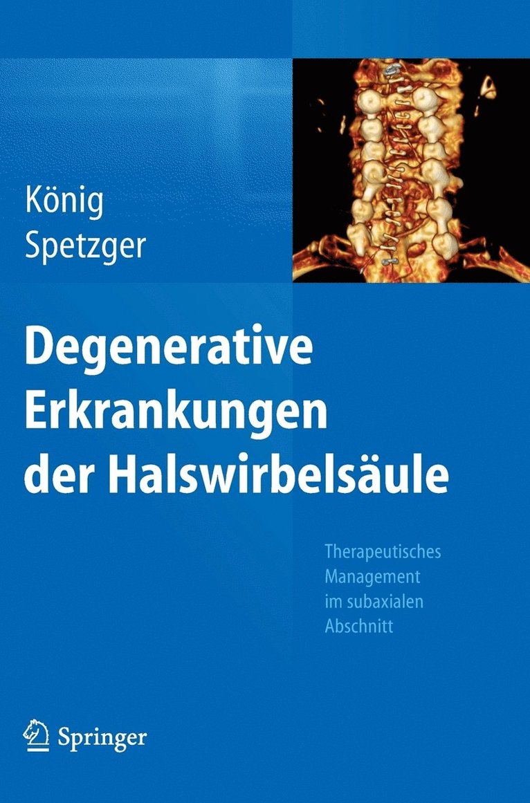 Stefan Alexander König, Uwe Spetzger, Stefan Alexander König, Uwe Spetzger - Degenerative Erkrankungen der Halswirbelsäule, Inbunden
