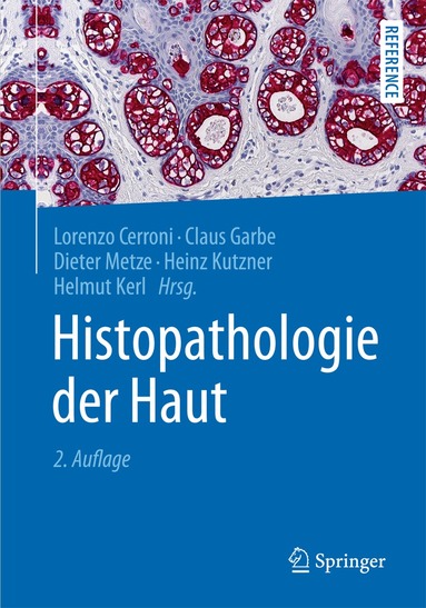 Lorenzo Cerroni, Claus Garbe, Dieter Metze, Heinz Kutzner, Helmut Kerl - Histopathologie der Haut, Inbunden