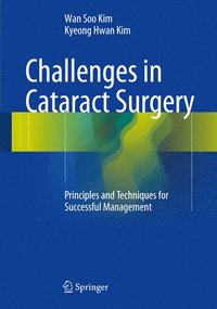 bokomslag Challenges in Cataract Surgery