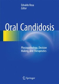 bokomslag Oral Candidosis