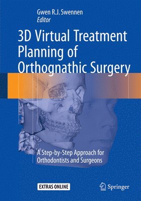 bokomslag 3D Virtual Treatment Planning of Orthognathic Surgery