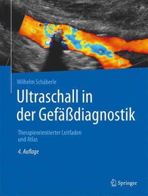Wilhelm Schäberle - Ultraschall in der Gefäßdiagnostik, Inbunden
