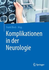 bokomslag Komplikationen in der Neurologie