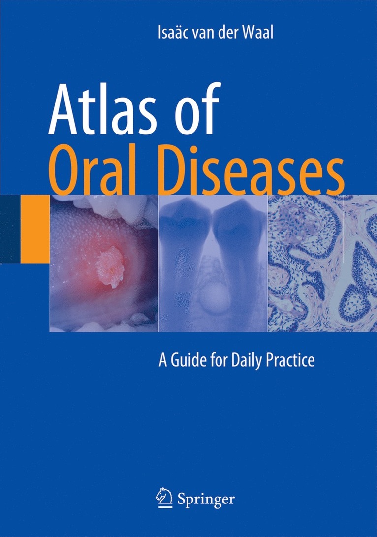 Isaäc van der Waal, Isaäc Van Der Waal, Isaäc van der Waal - Atlas of Oral Diseases, Inbunden
