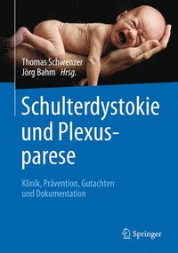 bokomslag Schulterdystokie und Plexusparese