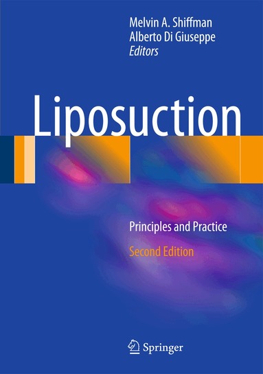 Melvin A. Shiffman, Alberto Di Giuseppe - Liposuction, Inbunden