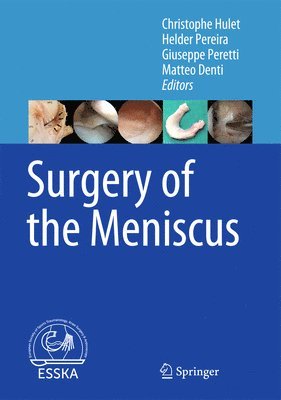 Christophe Hulet, Helder Pereira, Giuseppe Peretti, Matteo Denti - Surgery of the Meniscus, Inbunden