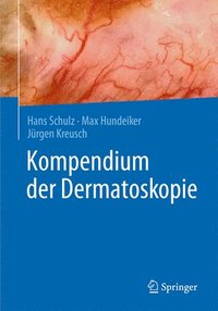 bokomslag Kompendium der Dermatoskopie